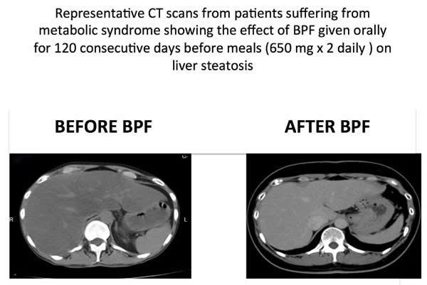 Bergamot CT steatosis