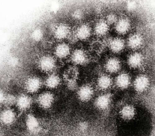 Transmission electron micrograph of Norovirus particles in faeces