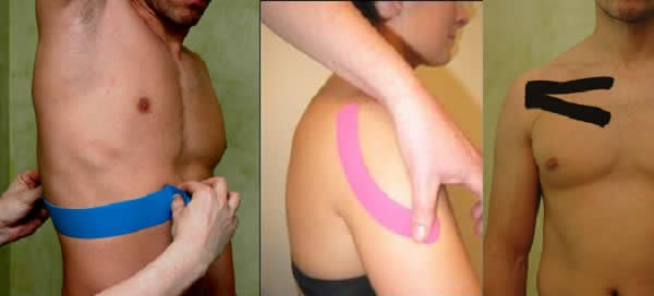 Neuromuscular Taping Collage