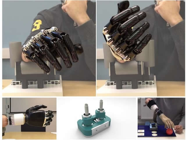 osseointegrated artificial wrist joint