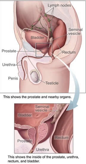 The Prostate Gland in Situ (Courtesy Wikipedia)