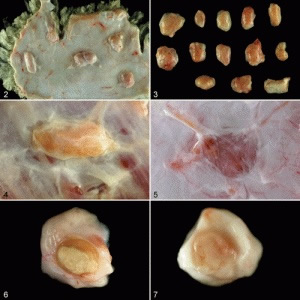 Granulomas under the vaccinated lambs’ skin were numerous and loaded with toxic aluminium