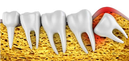 Teeth and Jaw Alignment