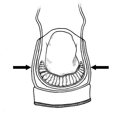 A firm heel counter (arrows) compresses the sides