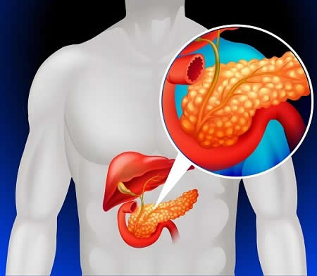 Understanding-Pancreatic-Cancer