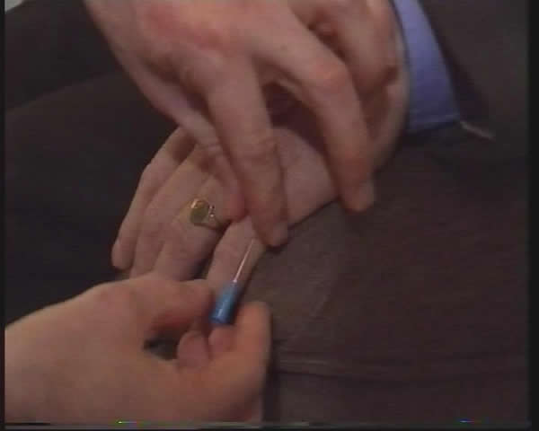 Hypnotic Pain control - close-up needle test