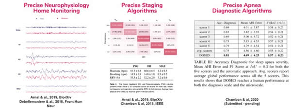 Dreem Study Results