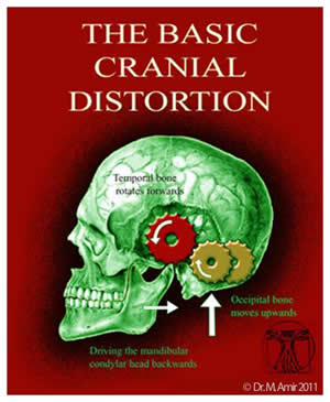 Basic Cranial Distortion