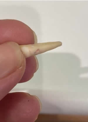 Example of an extracted tooth due to external root resorption