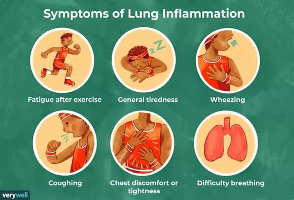 Lung Inflammation