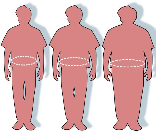 Obesity Image