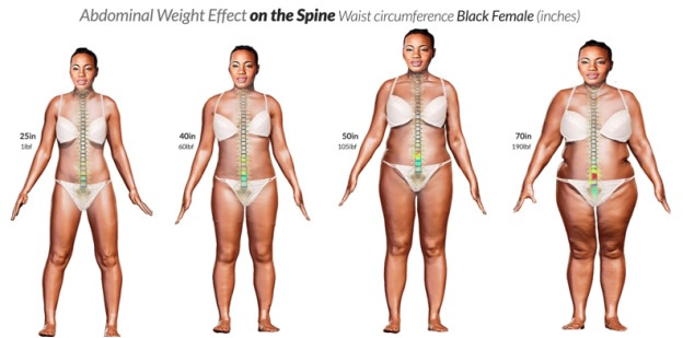Belly Fat Forces on the Spine