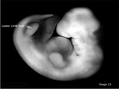 Embryo, Carnegie Stage 15