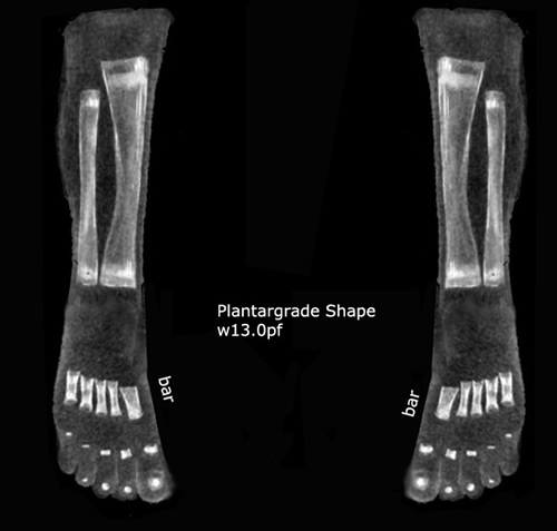 Plantargrade shape