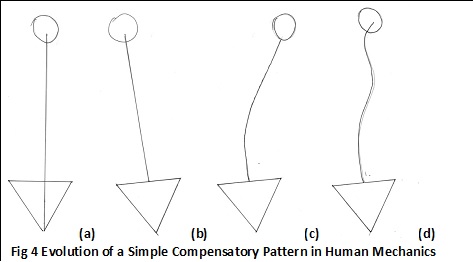 Fig 4 Evolution of a Simple Compensatory Pattern in Human Mechanics
