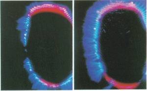 Kirlian photograph of a fingertip (left) before applying royal jelly and Vitamin E - the normal human aura.Kirlian photograph of a fingertip (right) after applying the cream Ã¢â‚¬â€œ note the extra energy given off. This is indicated by the greater regularity and intensity of the white lines.