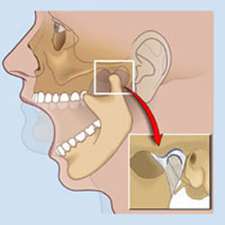 TMJ - its effects