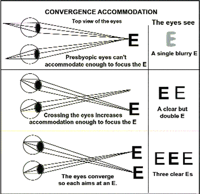 Figure 3. Showing convergence accommodation