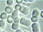 Clumped cells