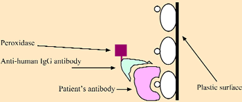 Showing attachment of peroxidase labelled goat-anti-human antibodies to the patient's antibody.