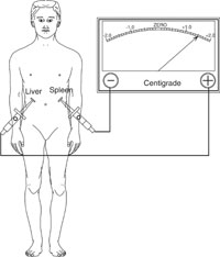 Figure 3: Differential Biological Energy Sensors are used to measure and compare the energy output of tissue, organs and glands