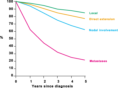 Figure 2: Stage-specific five-year relative survival for patients aged 15Ã¢â‚¬â€œ17, diagnosed in 1986Ã¢â‚¬â€œ89 in South East England (Source: Cancer Research Campaign Fact Sheet 6. Breast Cancer Ã¢â‚¬â€œ UK 1996)