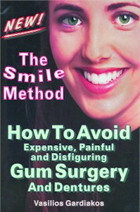 [Image: The Smile Method - How to Avoid Expensive, Painful and Disfiguring Gum Surgery and Dentures]