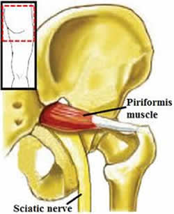 piriformis muscle