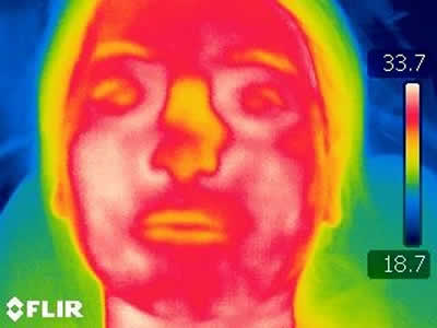 Thermography Shows Infection