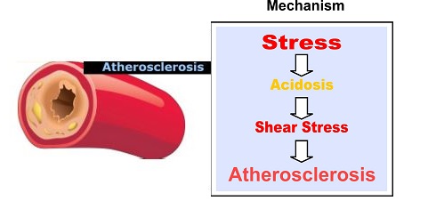 Mechanism Atherosclerosis