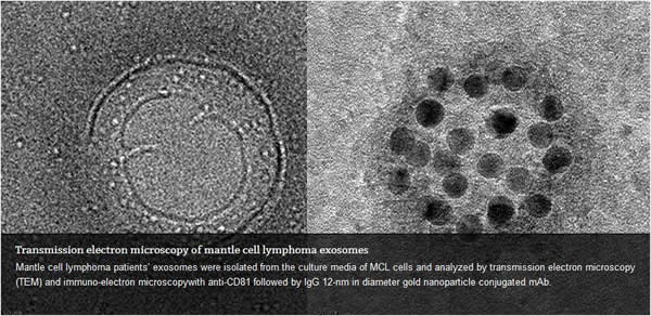Mantle Cell Lymphoma Exosomes Transmission Electron Microscopy