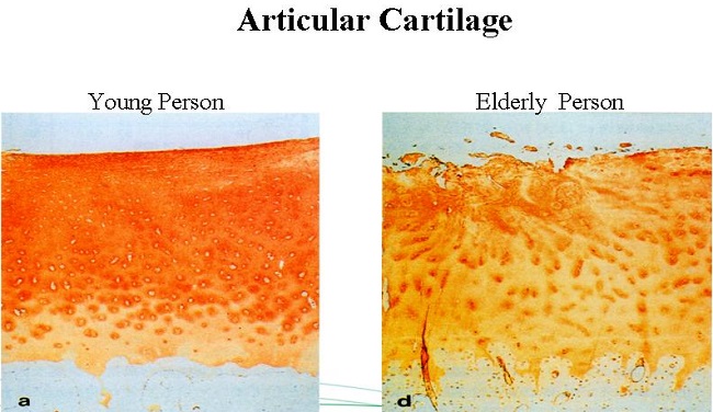 Articular Cartilage in Young and Elderly