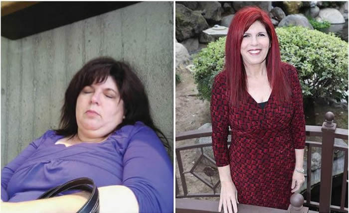 Carol Adkisson Before and After