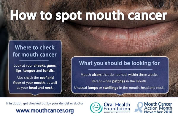 How to Spot Mouth Cancer