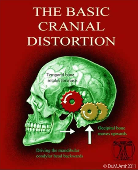 The Basic Cranial Distortion white rule cropped
