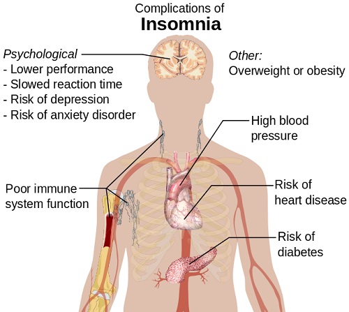 Wikipedia Complications of Insomnia