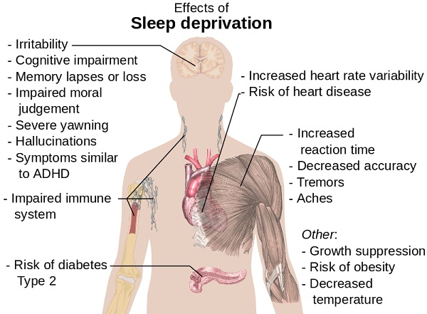 Wikipedia Effects of Sleep Deprivation