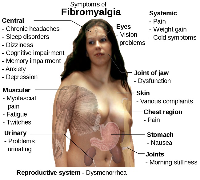 Dr Amir 255 Recovery from Fibromyalgia