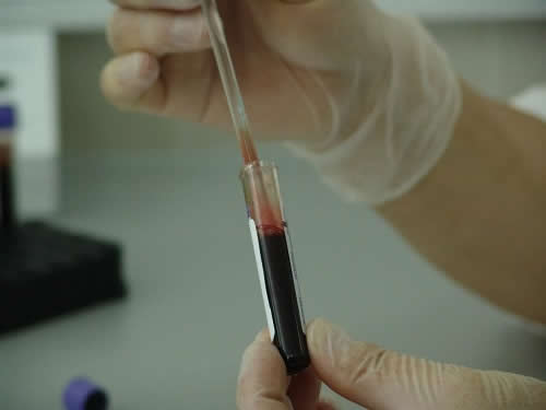 The dogs involved in the cancer detection tests are often given blood samples to smell