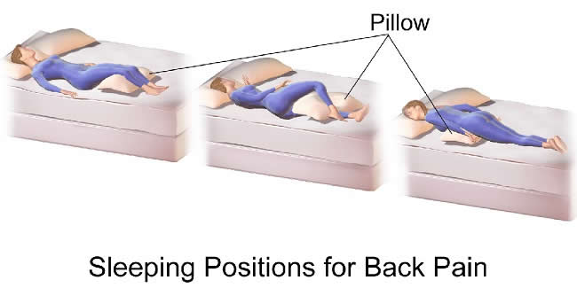Sleeping_Positions_for_Back_Pain