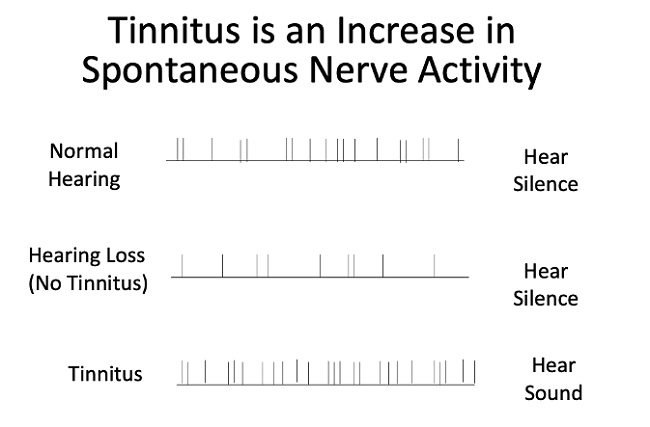 Tinnitus Increases Spontaneous Nerve Firing