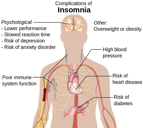 Complications_of_insomnia 550x492px.jpg]
