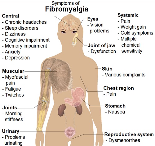 Symptoms_of_fibromyalgia