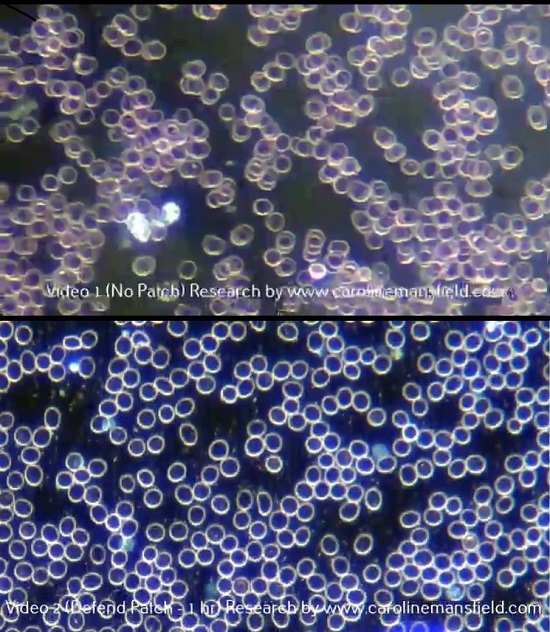 Dark Field Microscopy Effect of Super Patch upon Live Blood Analysis